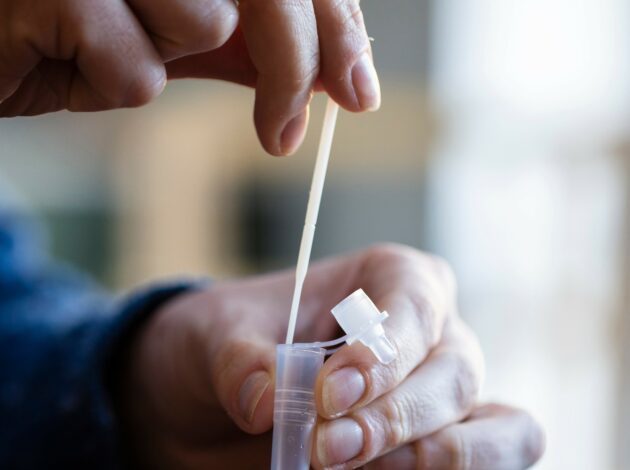Picture of a person doing a swab test